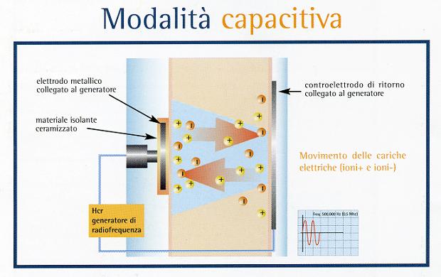 Tecarterapia: modalità d'applicazione Capacitiva