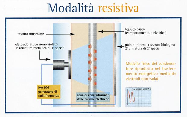 Tecarterapia: modalità d'applicazione Resistiva